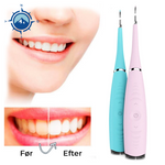 Ultrasonic Teeth Cleaner